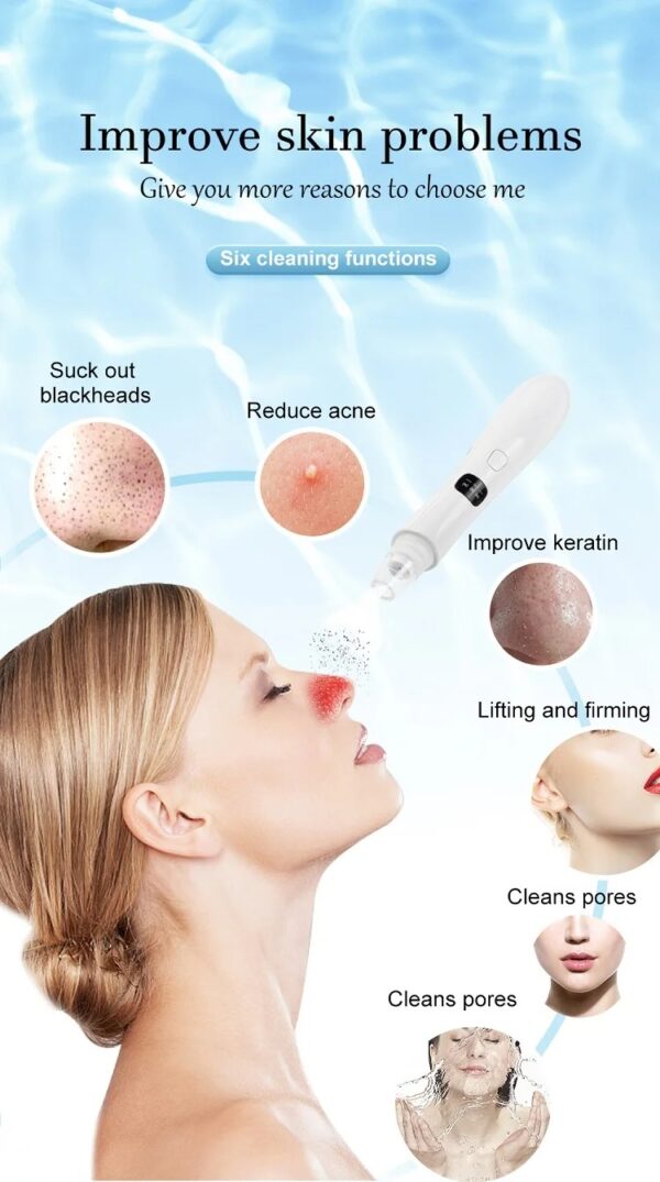 3 Suction Mode Face Cleansing Beauty Machine Dead Skin Remover Face Vacuum Blackhead Removal Skin - Image 6