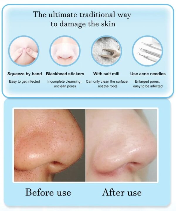 3 Suction Mode Face Cleansing Beauty Machine Dead Skin Remover Face Vacuum Blackhead Removal Skin - Image 9